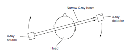 540_Computer assisted tomography (CAT).png